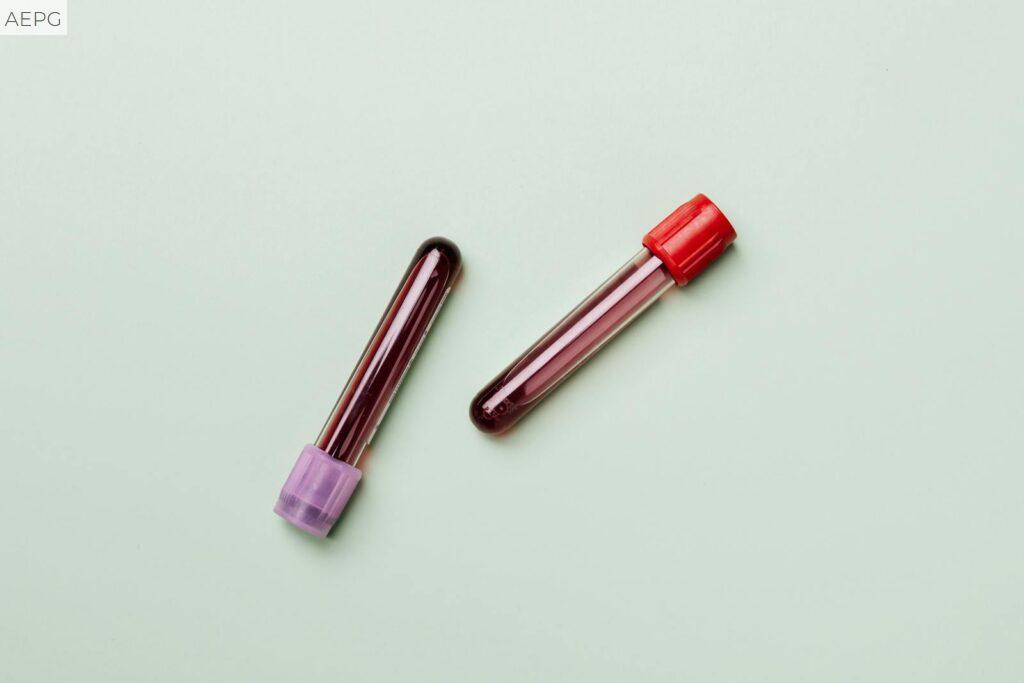 analisis de sangre