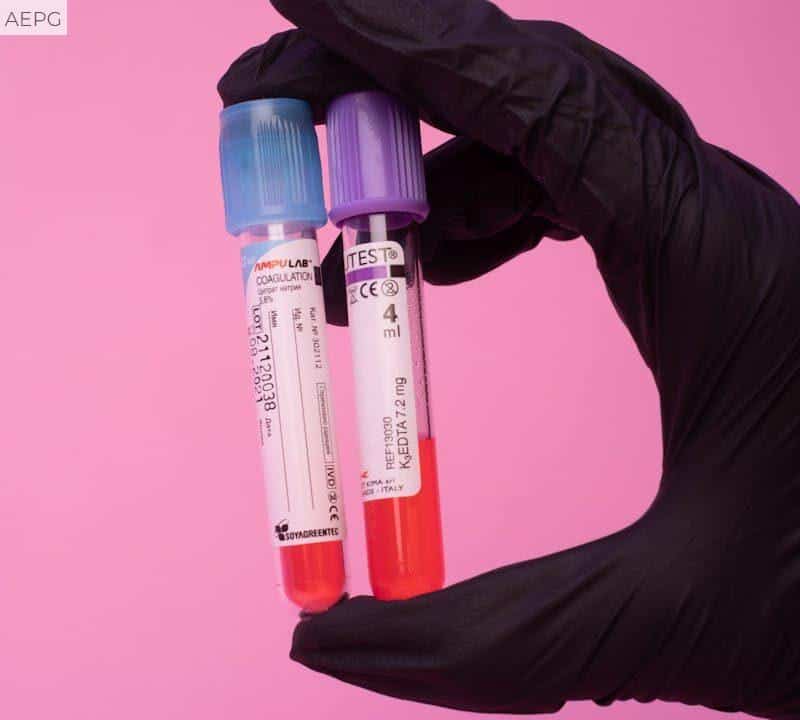 analisis de sangre