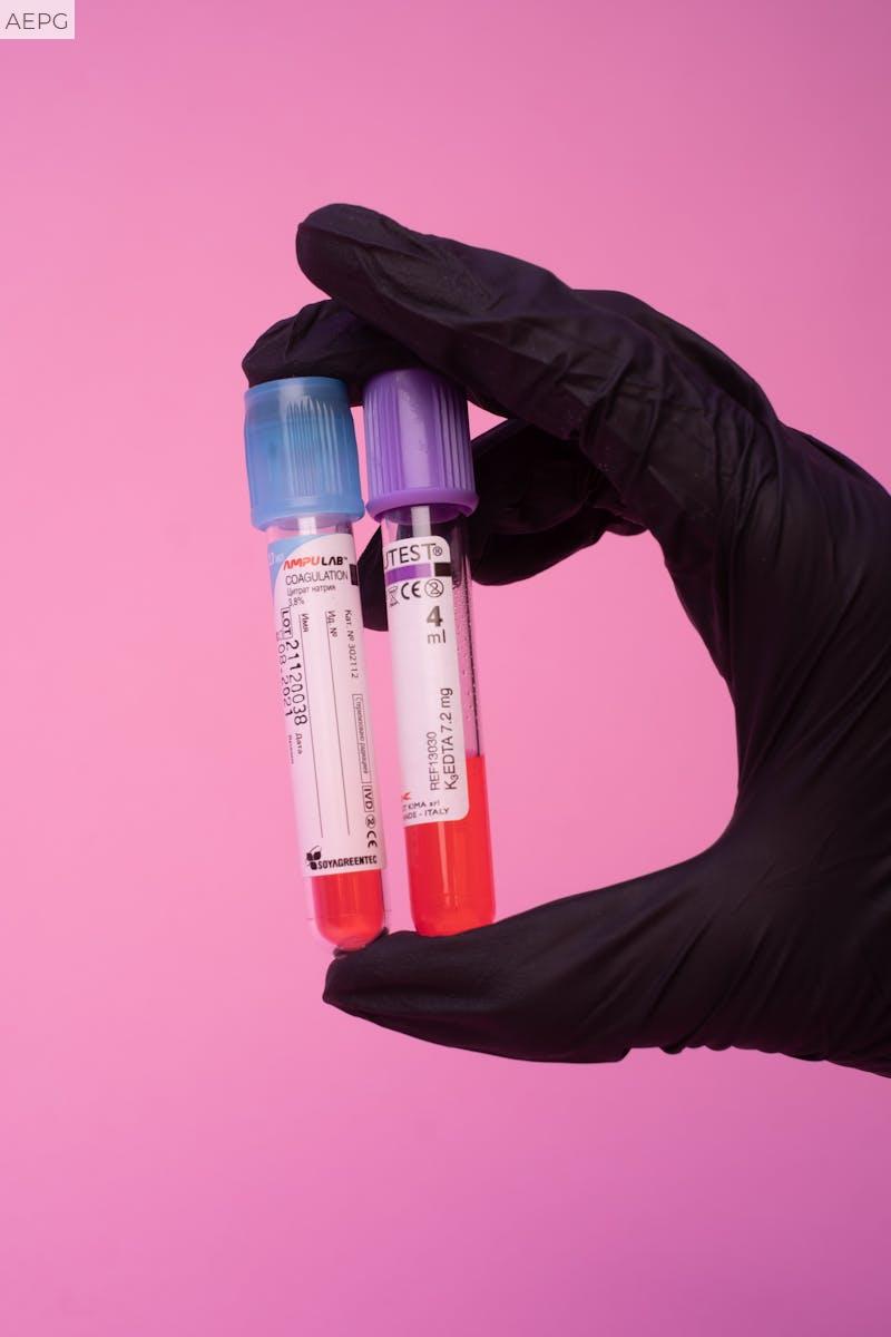 analisis de sangre